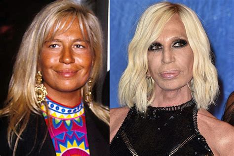 antonella versace prima della ricostruzione|donatella versace vita privata.